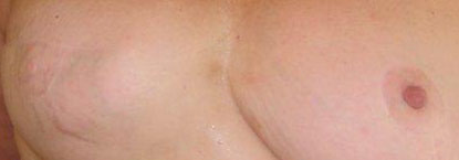 IMG_0922-breasts